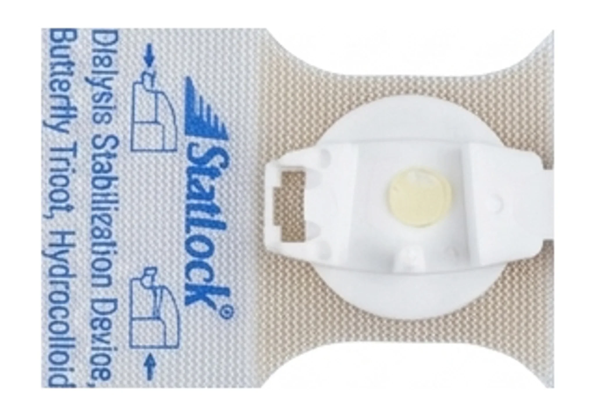 StatLock™ Dialysis Stabilization Device, Butterfly Tricot, Hydrocolloid