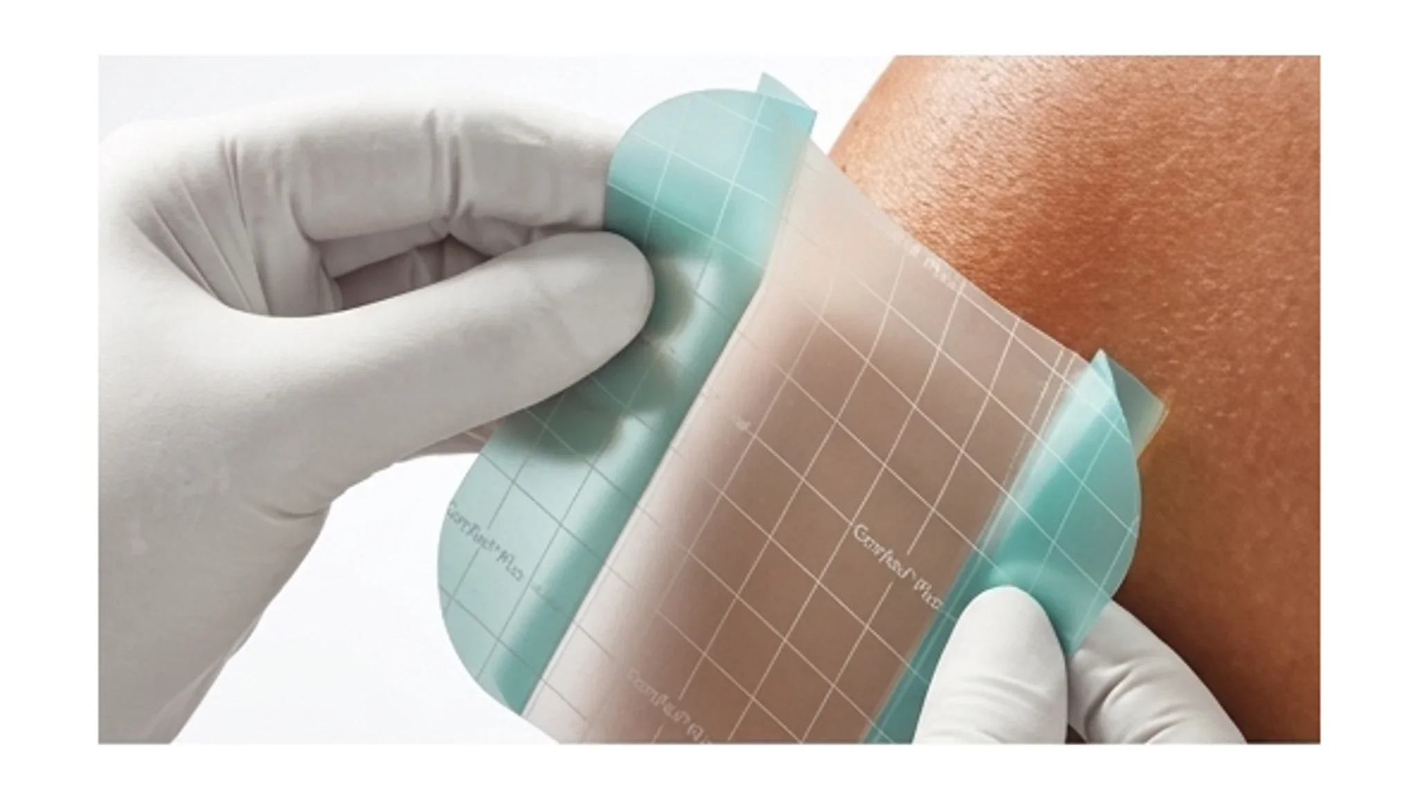 Comfeel® Plus Clear Hydrocolloid Dressing 5cm x 15cm